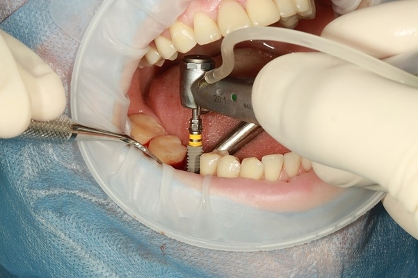 dental-depart-1